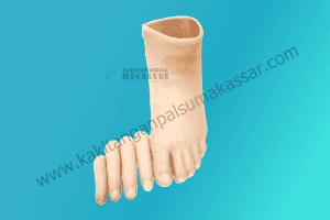 Kaki Palsu Makassar - Tangan Palsu Makassar - Hubungi 085394849766