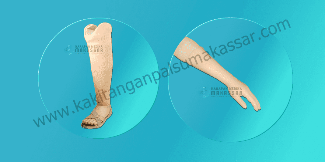 Kaki Palsu Makassar - Tangan Palsu Makassar - Hubungi 085394849766