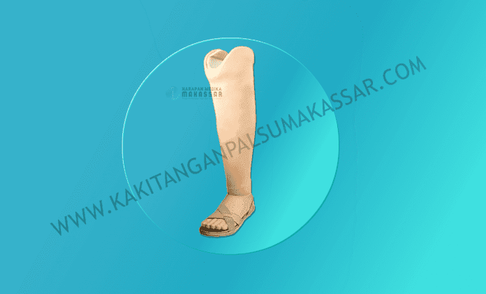 Kaki Palsu Makassar - Tangan Palsu Makassar - Hubungi 085394849766