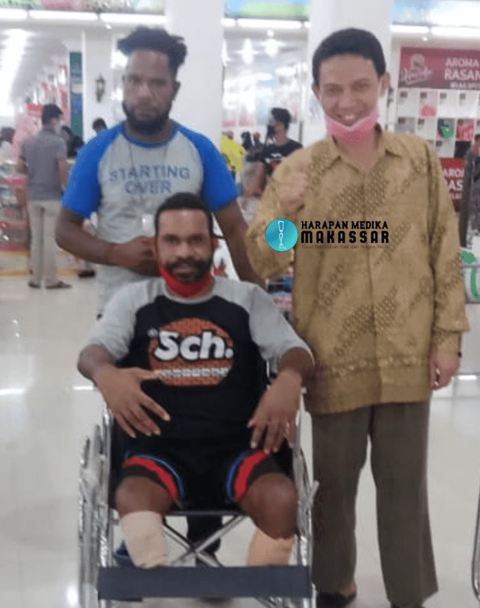 KISAH INSPIRATIF PASIEN AMPUTASI KAKI DI PAPUA KISAH INSPIRATIF PASIEN AMPUTASI KAKI DI PAPUA