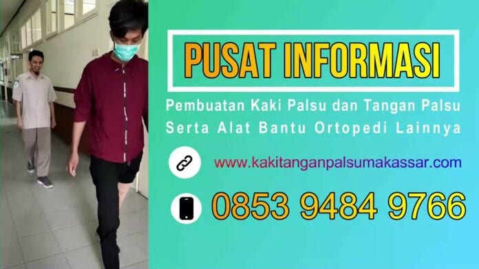 524 Harga Kaki Palsu