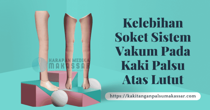 Kelebihan Soket Sistem Vakum Pada Kaki Palsu Atas Lutut Kaki Palsu Makassar KELEBIHAN SOKET SISTEM VAKUM PADA KAKI PALSU ATAS LUTUT