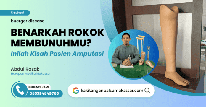Buerger disease ini terjadi akibat pembuluh darah perifer yang mengalami sumbatan ke bagian ujung tungkai kaki sehingga nutrisi makanan dan oksigen sangat tidak mencukupi kebutuhannya yang tentu berakibat resiko kematian jaringan tubuh