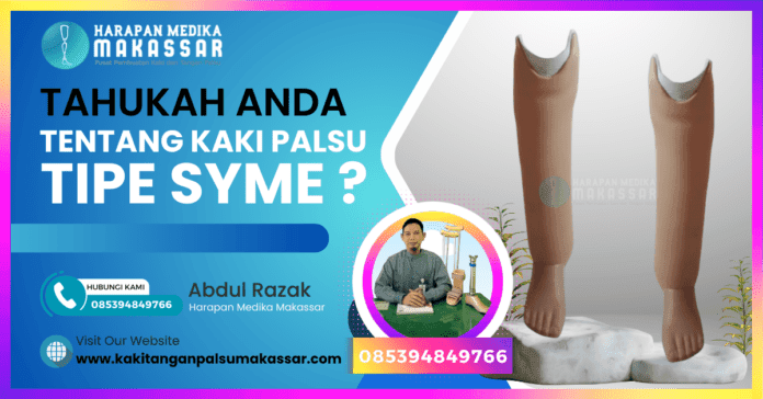 Pembesaran soket kaki palsu: Ilustrasi bagian bawah soket kaki palsu Syme yang menjadi fokus estetika