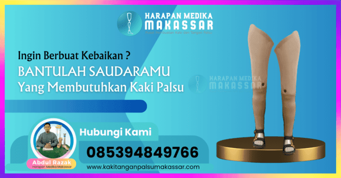 INGIN BERBUAT KEBAIKAN - BANTULAH SAUDARAMU YANG MEMBUTUHKAN KAKI PALSU