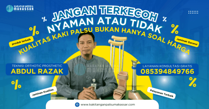 JANGAN TERKECOH, NYAMANNYA KAKI PALSU TIDAK DITENTUKAN HARGA KAKI PALSU SEMATA Terobosan Kaki Palsu: Kenyamanan Tak Lagi Tergantung pada Harga!