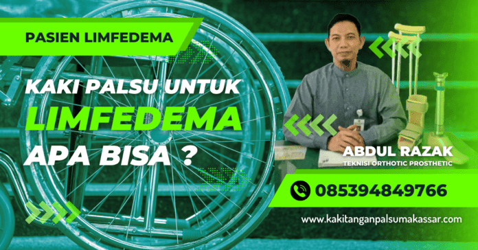 Pembuatan Kaki Palsu untuk Penderita Penyakit Limfedema Kaki Gajah, Apa Bisa menggunakan kaki palsu saat melakukan latihan rehabilitasi untuk mengatasi limfedema yang disebabkan oleh kaki gajah
