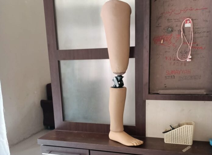 Kaki palsu atas lutut bantu Anda kembali berjalan & beraktivitas! Pelajari fungsinya, cara memilih, & tips perawatan. Tingkatkan mobilitas & kemandirian Anda.