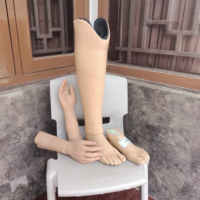 Tips Menunggu Kaki Palsu dengan Aman dan Nyaman