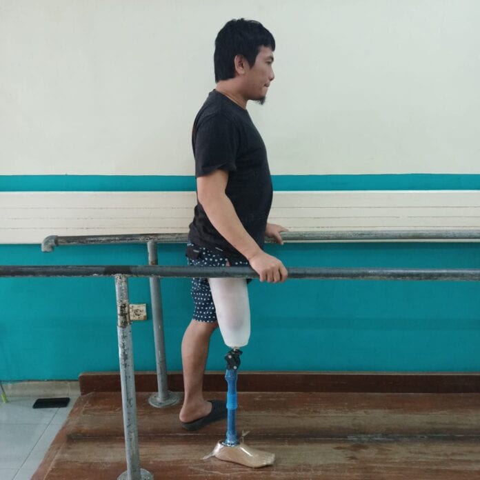 LATIHAN TAHAPAN AKHIR MENGGUNAKAN KAKI PALSU Foto seorang pasien amputasi sedang berjalan dengan kaki palsu.
