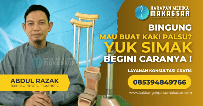 Bingung Mau Membuat Kaki Palsu Yuk Simak, Begini Caranya! Bingung Mau Membuat Kaki Palsu? Yuk Simak, Begini Caranya!