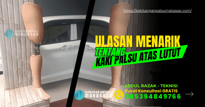 Belaja Tentang Kaki Palsu Tepat Lutut, GRATIS Konsultasi Kaki Palsu