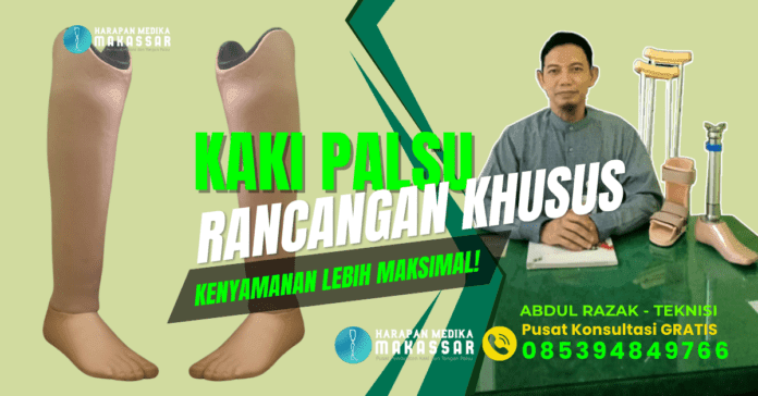 KAKI PALSU BAWAH LUTUT HARGA TERJANGKAU LEBIH NYAMAN DI GUNAKAN Kaki palsu tanpa sabuk, lebih nyaman untuk aktivitas harian! Melangkah stabil tanpa ribet, solusi modern untuk amputasi bawah lutut! Bebas bergerak, kaki palsu bawah lutut terbaik untuk Anda! Hidup baru dimulai dengan langkah yang lebih percaya diri! Rasakan teknologi kaki palsu modern, nyaman dan simpel digunakan! Prostetik tanpa sabuk, langkah ringan untuk hari yang ceria! Solusi prostetik canggih, mobilitas maksimal tanpa batas! Desain inovatif, nyaman dipakai, cocok untuk kebutuhan Anda! Langkah pasti, nyaman, dan stabil dengan kaki palsu modern! Kembali aktif dengan kaki palsu yang dirancang khusus untuk Anda!
