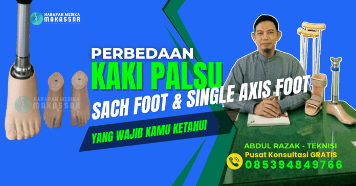 Cocok untuk Aktivitas Berat! Ini Dia Perbedaan Kaki Palsu SACH Foot dan Single Axis Foot yang Wajib Diketahui