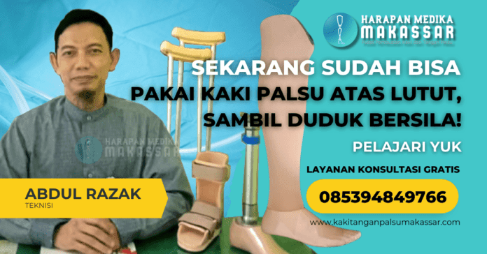 Temukan solusi kaki palsu atas lutut yang nyaman dan fungsional di Makassar. Pelajari tips memilih prostetik, kemampuan duduk bersila, dan layanan pembuatan kaki palsu, tangan palsu, serta alat bantu ortopedi lainnya. Hubungi kami di 0853-9484-9766