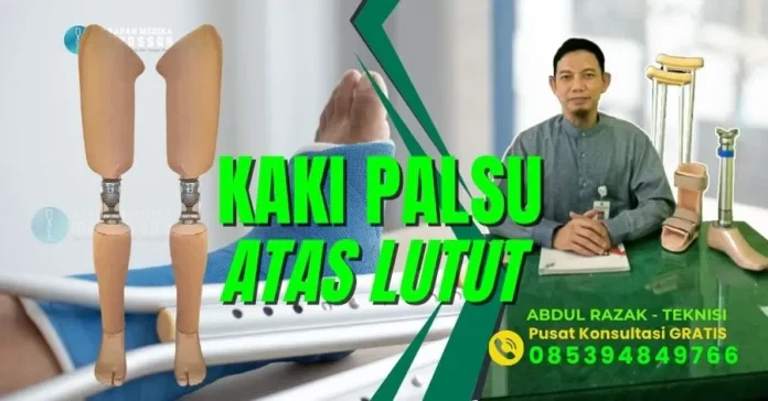 Hal Penting yang Perlu Anda Ketahui tentang Kaki Palsu Atas Lutut