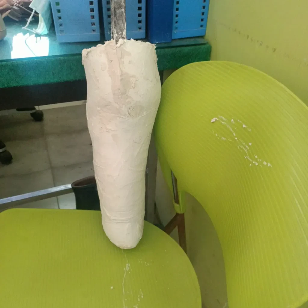 Cara Membuat Kaki Palsu Bawah Lutut yang Nyaman dan Presisi – Langkah Demi Langkah