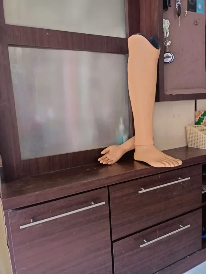 Pelajari mengapa penderita diabetes berisiko mengalami amputasi kaki, bagaimana cara mencegahnya, serta informasi penting seputar perawatan luka diabetes dan penggunaan kaki palsu. Meta Keywords: diabetes, amputasi kaki, luka diabetes, neuropati diabetes, kaki palsu, komplikasi diabetes, perawatan luka diabetes, PAD, gangren