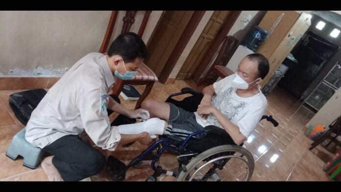 teknisi melakukan casting kaki palsu bawah lutut