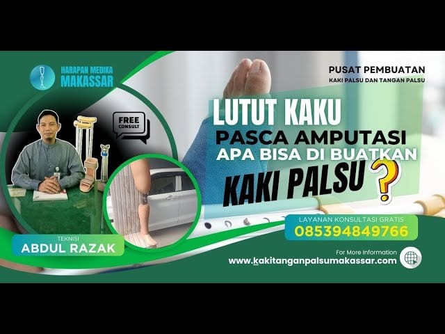 Kaki Palsu dan Kekakuan Lutut: Cara Mudah Mengatasinya yang Tak Banyak Orang Tahu!