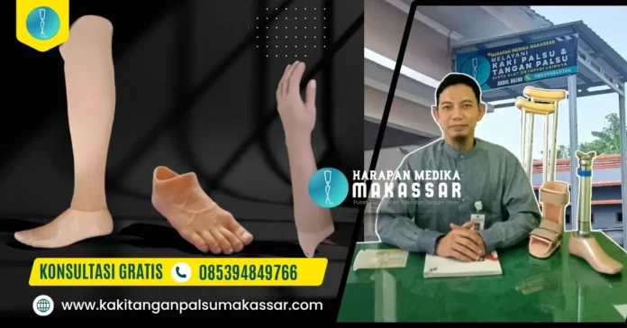Pembuatan Kaki Palsu dan Tangan Palsu di Palu Gorontalo