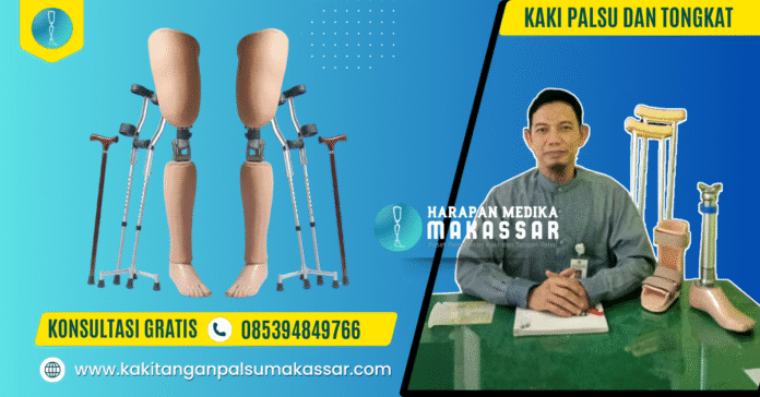 Kaki Palsu dan Tongkat