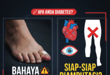 APAKAH ANDA DIABETES? KENALI RESIKO YANG BISA TERJADI resiko-komplikasi-diabetes
