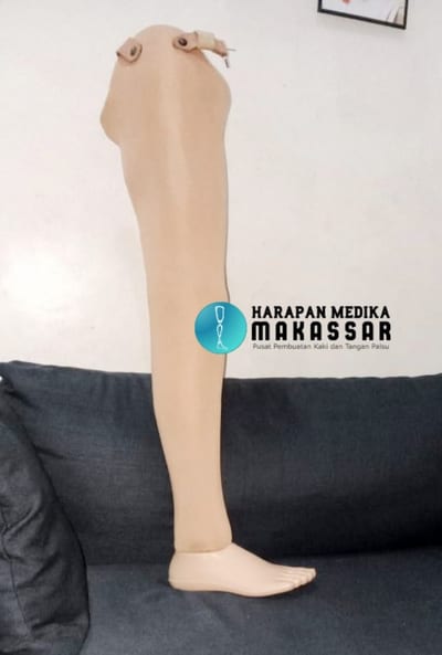 INILAH KRITERIA KAKI PALSU YANG BAIK