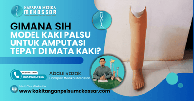 Gimana Sih Model Kaki Palsu untuk Amputasi Tepat di Mata Kaki?