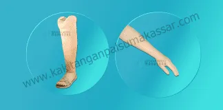 BUTUH KAKI PALSU dan TANGAN PALSU MURAH DAN BERKUALITAS? Kaki Palsu Makassar - Tangan Palsu Makassar - Hubungi 085394849766