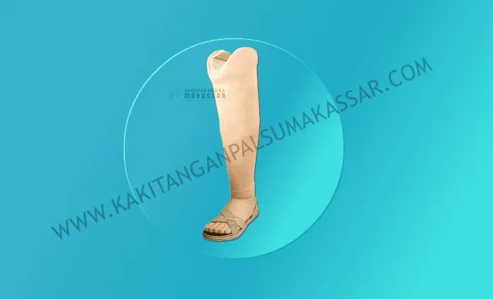 Kaki Palsu Makassar - Tangan Palsu Makassar - Hubungi 085394849766