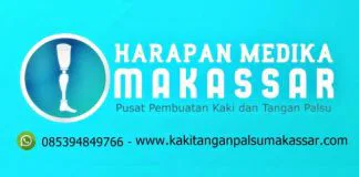 MENGENAL MANFAAT DAN PERBEDAAN KAKI PALSU DAN TANGAN PALSU