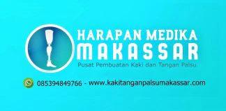 PROSES PEMBUATAN KAKI PALSU PASIEN DARI BALIKPAPAN, KOTA BARU, SAMARINDA DAN BANJARMASIN