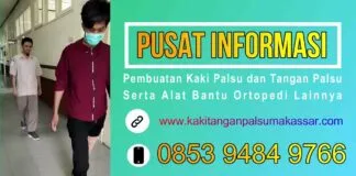 KAKI PALSU ANDA SUDAH LONGGAR ? INI SOLUSINYA