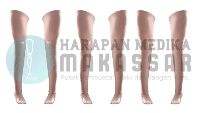 kaki palsu terbaik Kaki Palsu Kualitas Terbaik