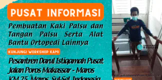 Butuh Kaki Palsu Ringan dan Berkualitas ? Ini Lokasinya teknik dasar latihan bagi pengguna kaki palsu
