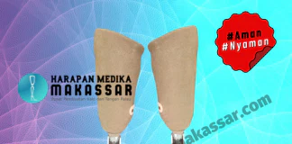 WOW… TERNYATA KAKI PALSU BISA DI BUAT LEBIH RINGAN Kaki Palsu Ringan Aman dan Nyaman