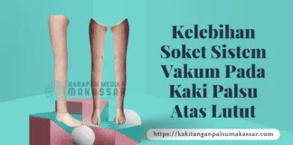 INILAH KELEBIHAN SOKET SISTEM VAKUM PADA KAKI PALSU ATAS LUTUT KELEBIHAN SOKET SISTEM VAKUM PADA KAKI PALSU ATAS LUTUT