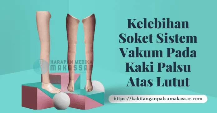 KELEBIHAN SOKET SISTEM VAKUM PADA KAKI PALSU ATAS LUTUT
