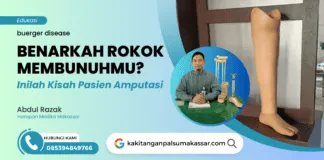 BENARKAH ROKOK MEMBUNUHMU? INILAH KISAH PASIEN AMPUTASI Buerger disease ini terjadi akibat pembuluh darah perifer yang mengalami sumbatan ke bagian ujung tungkai kaki sehingga nutrisi makanan dan oksigen sangat tidak mencukupi kebutuhannya yang tentu berakibat resiko kematian jaringan tubuh