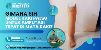 GIMANA SIH MODEL KAKI PALSU UNTUK AMPUTASI TEPAT DI MATA KAKI? Gimana Sih Model Kaki Palsu untuk Amputasi Tepat di Mata Kaki?
