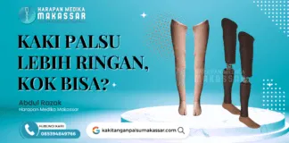 KAKI PALSU LEBIH RINGAN, KOK BISA? Kaki Palsu bahan carbon memiliki keunggulan estetika dan bahannya cukup ringan. Kekurangannya adalah harganya yang cukup mahal
