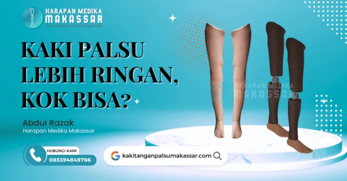 Kaki Palsu bahan carbon memiliki keunggulan estetika dan bahannya cukup ringan. Kekurangannya adalah harganya yang cukup mahal