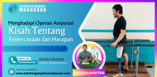 INILAH KISAHKU SAAT KAKI YANG KUSAYANGI HARUS BERPISAH DARI TUBUH