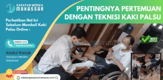 Perhatikan Hal Ini Sebelum Membeli Kaki Palsu Online: Pentingnya Pertemuan dengan Teknisi Kaki Palsu Perhatikan Hal Ini Sebelum Membeli Kaki Palsu Online