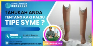 Tahukah Anda tentang Kaki Palsu Tipe Syme? Pembesaran soket kaki palsu: Ilustrasi bagian bawah soket kaki palsu Syme yang menjadi fokus estetika