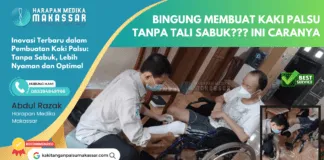 Inovasi Terbaru dalam Pembuatan Kaki Palsu: Tanpa Sabuk, Lebih Nyaman dan Optimal Inovasi Terbaru dalam Pembuatan Kaki Palsu: Tanpa Sabuk, Lebih Nyaman dan Optimal