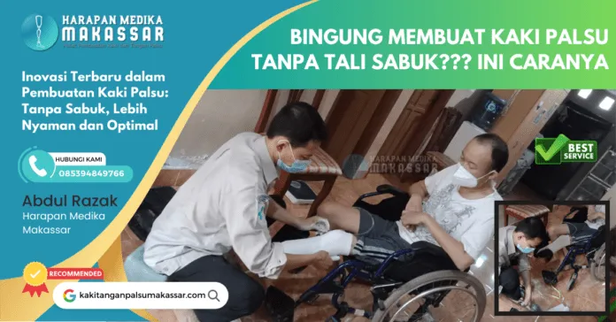 Inovasi Terbaru dalam Pembuatan Kaki Palsu: Tanpa Sabuk, Lebih Nyaman dan Optimal