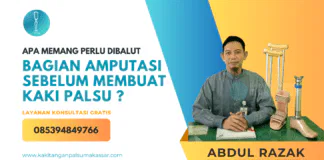 APA MEMANG PERLU DIBALUT BAGIAN AMPUTASI SEBELUM MEMBUAT KAKI PALSU❔ Proses Pembalutan Elastis Perban Sebelum Membuat Kaki Palsu: Pentingnya Langkah Ini untuk Kenyamanan Pasien