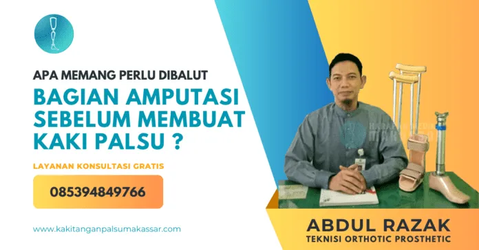 APA MEMANG PERLU DIBALUT BAGIAN AMPUTASI SEBELUM MEMBUAT KAKI PALSU Proses Pembalutan Elastis Perban Sebelum Membuat Kaki Palsu: Pentingnya Langkah Ini untuk Kenyamanan Pasien